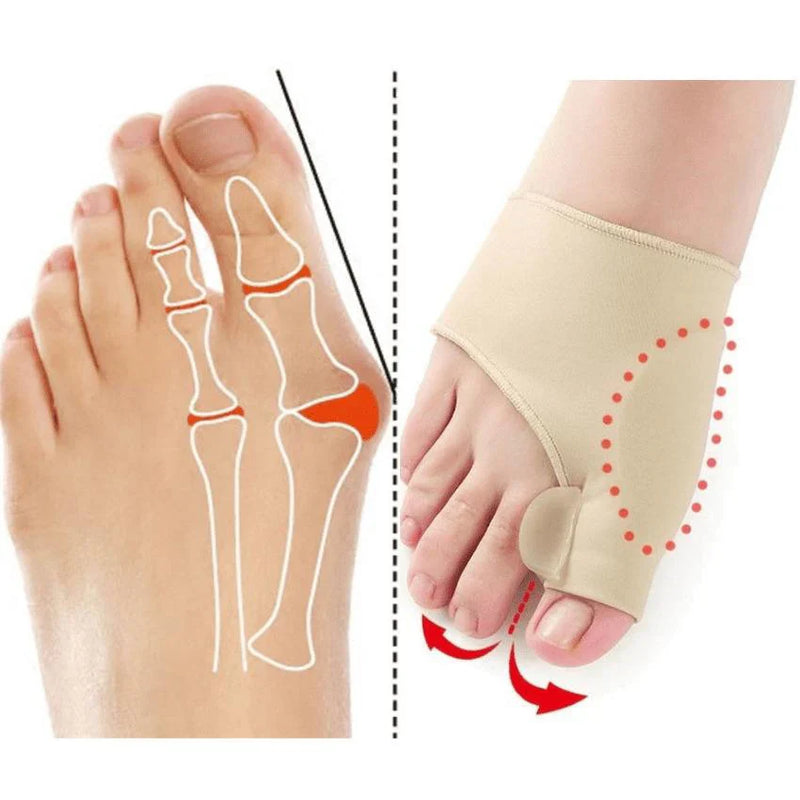 Correctmax™ | Corrector ortopédico de Juanetes + regalo